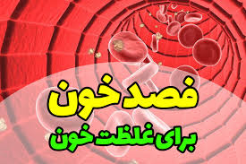 تعریف فصد
